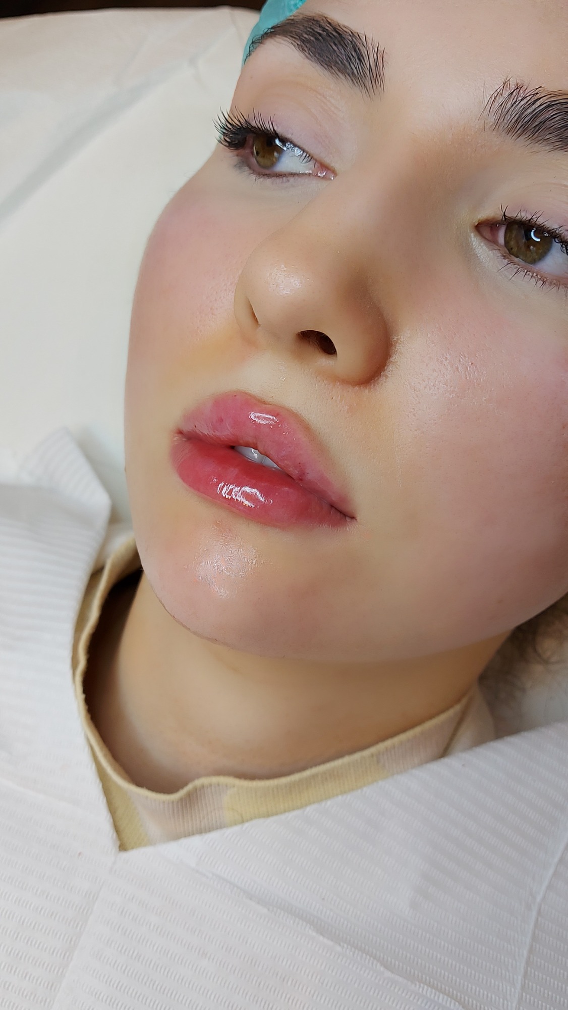 Russian Lips für schmale Lippen. Frau mit glänzenden Lippen, neutralem Gesichtsausdruck auf einer Liege.
