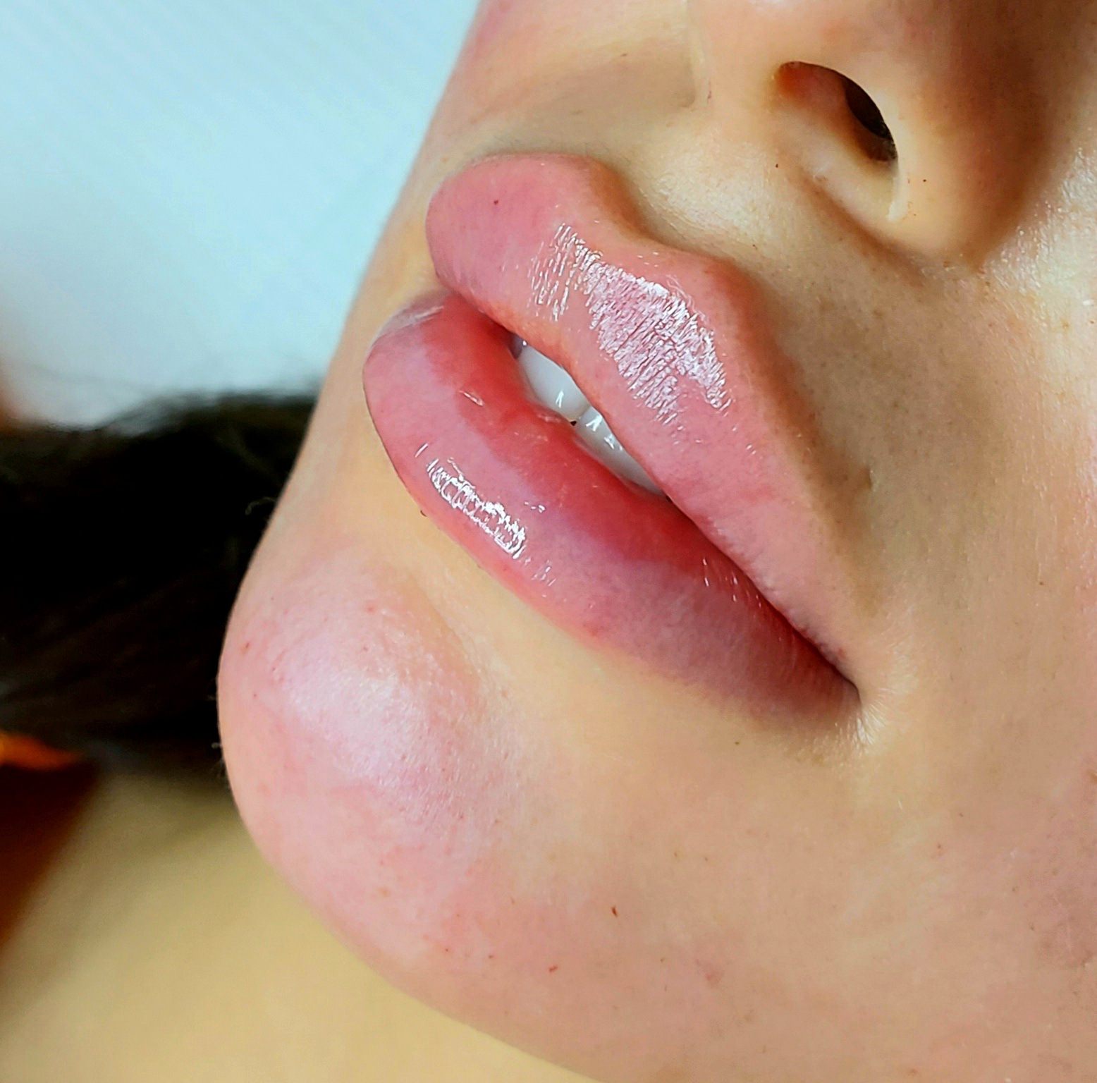 Russian Lips bei Natalia Hamann Nahaufnahme von rosigen, glänzenden Lippen mit sanften Konturen.
