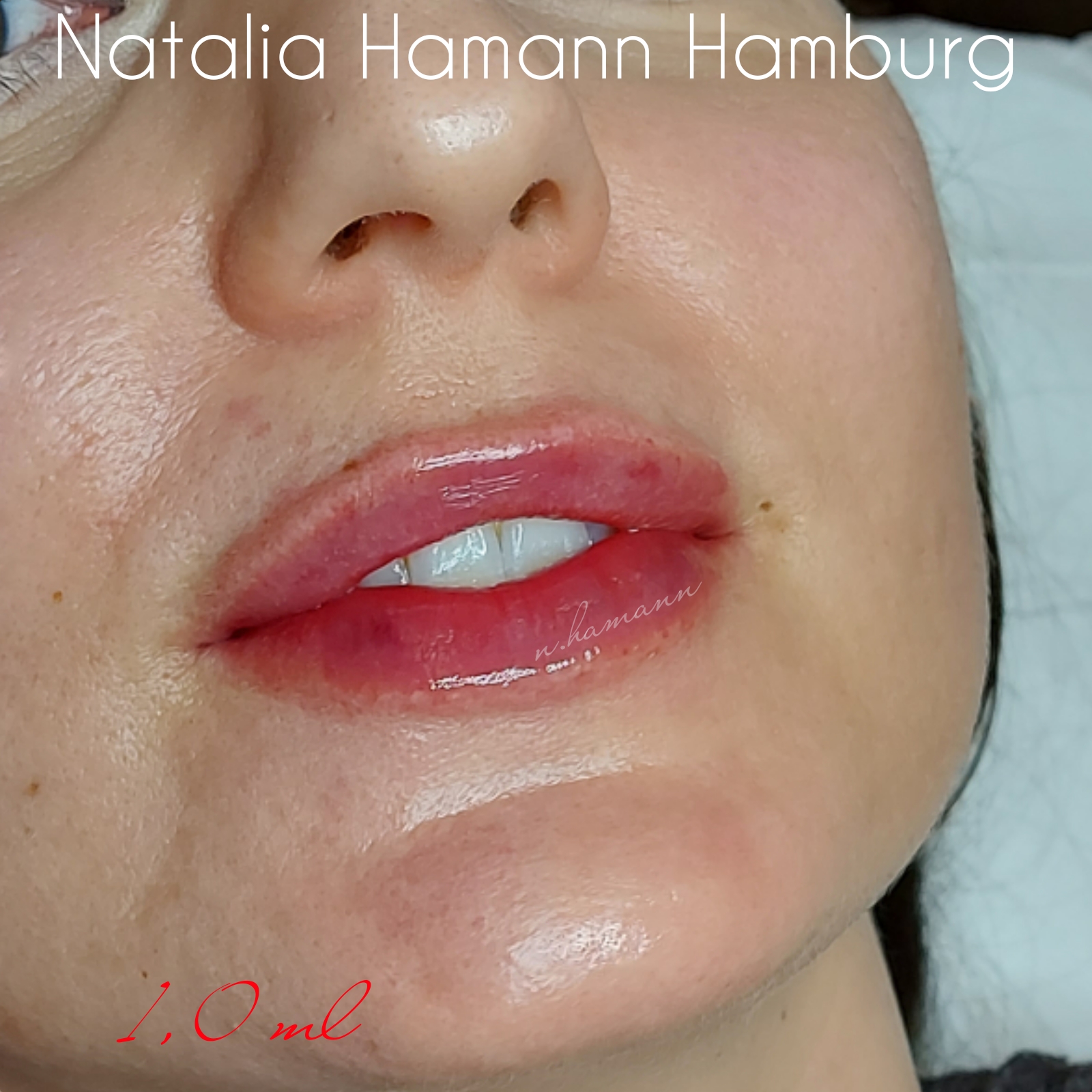 Russian Lips Technik bei schmalen Lippen Nahaufnahme eines Gesichts mit betonten Lippen und glänzender Haut.